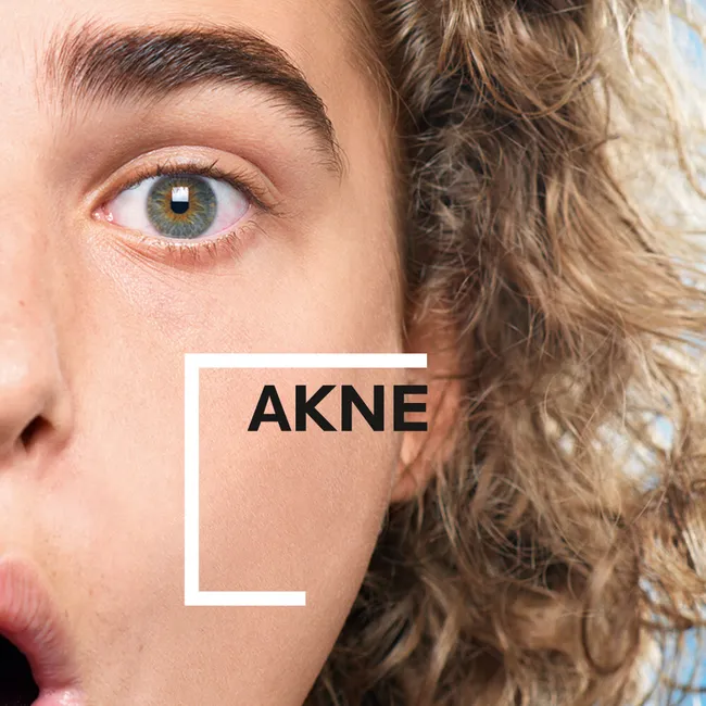 La Roche-Posay Effaclar Hochkonzentriertes Serum bei Akne & Pickelmalen (Peeling mit AHA & BHA)